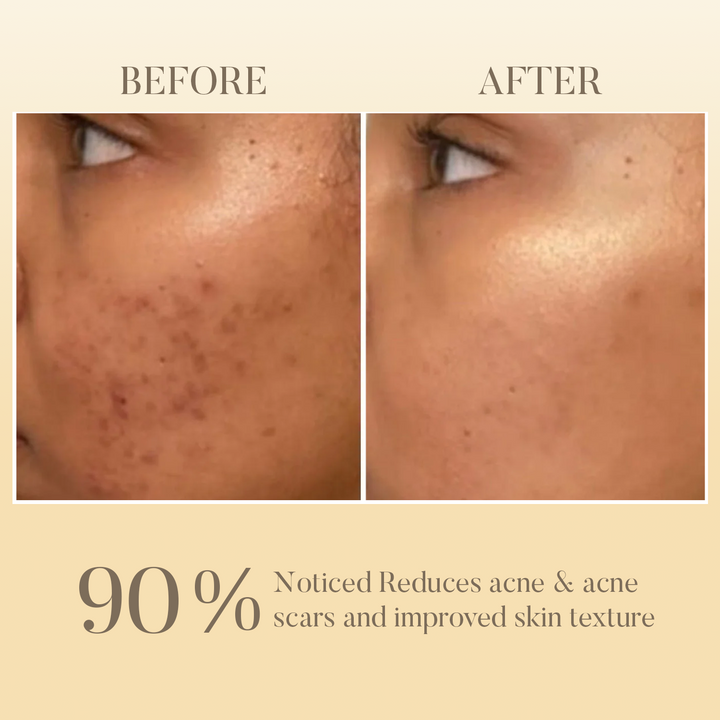 Neem & Tulsi Hydrating Gel