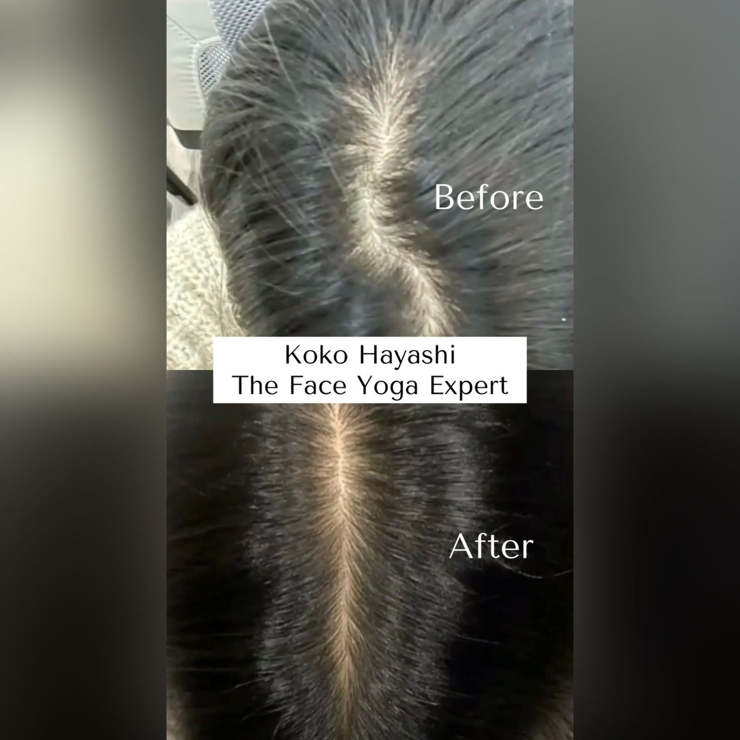 Keshya Hair Vitalizer - Hair Growth Serum