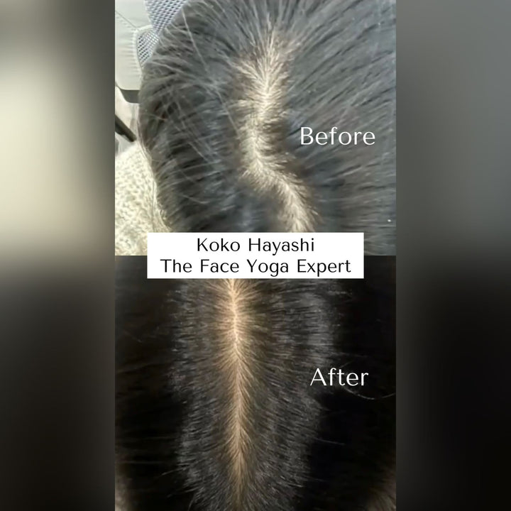 Keshya Hair Vitalizer - Hair Growth Serum